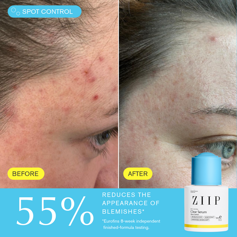 Clear Salicylic Acid Serum