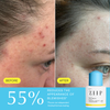 Clear Salicylic Acid Serum