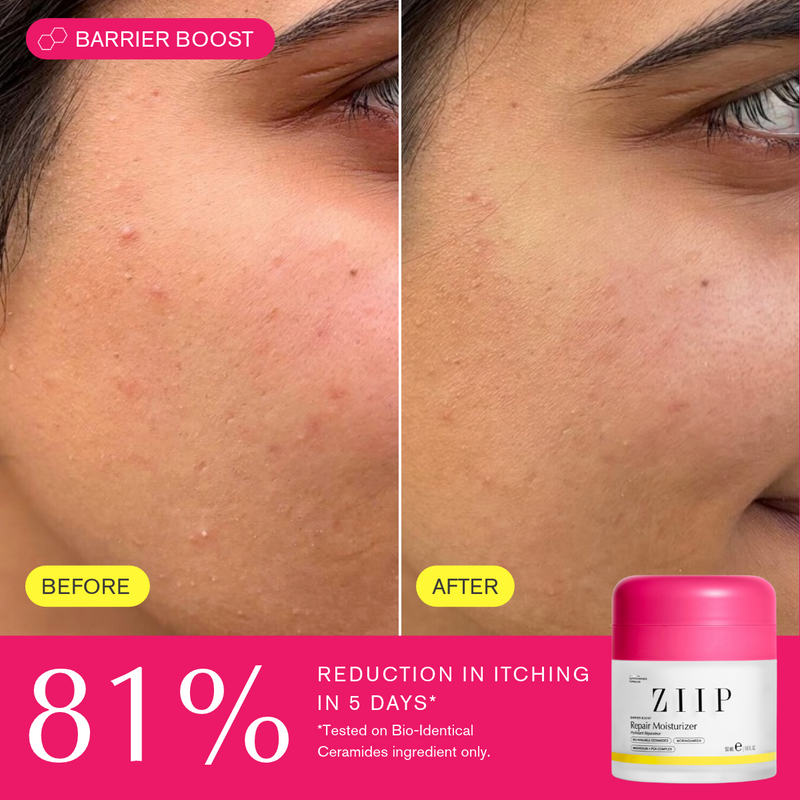 Repair Ceramide Moisturiser